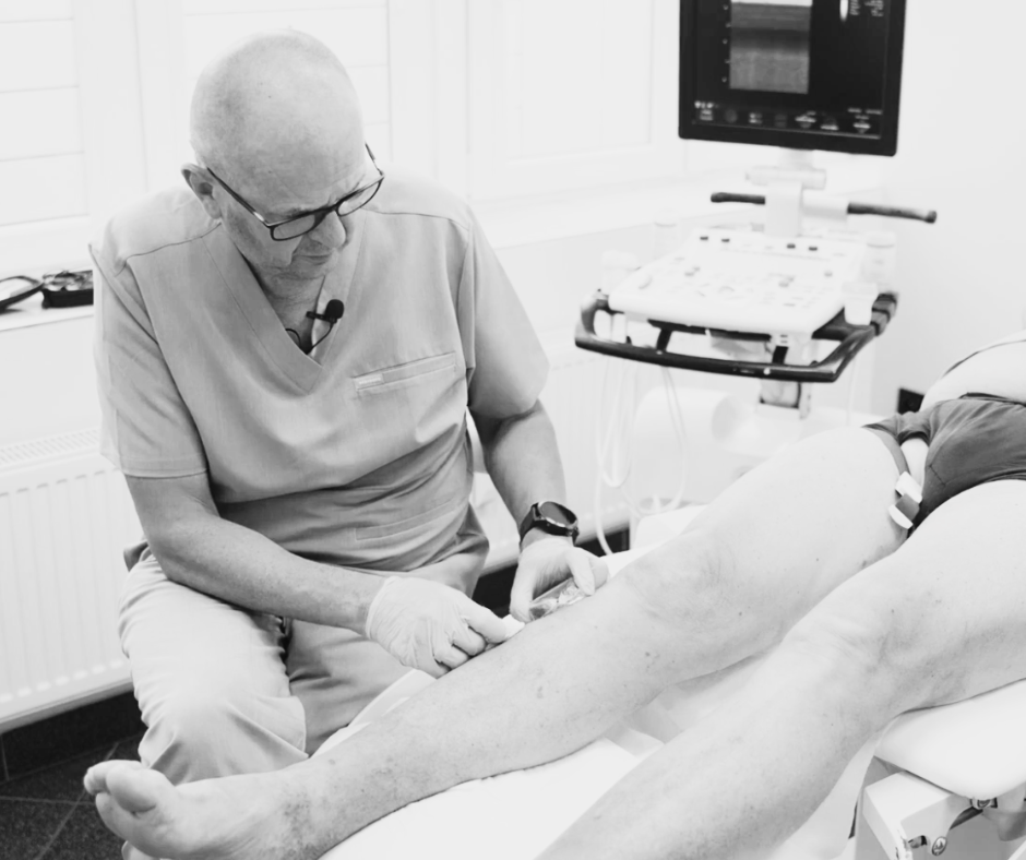 Zdjęcie przedstawia zabieg skleroterapii żylaków na nogach wykonywany przez prof. Artura Pupkę.