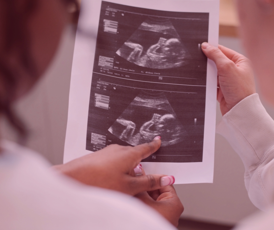 Zdjęcie przedstawia wynik USG badania prenatalnego omawiany z ciężarną przez lekarza.